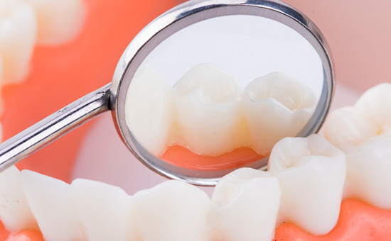 合肥种植牙医院排名前五“发布”刚种完牙能吃什么东西(图1)