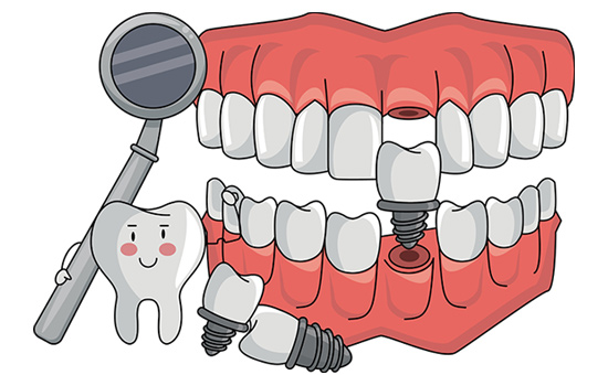合肥牙齿矫正:儿童能用隐形矫正器吗(图1)